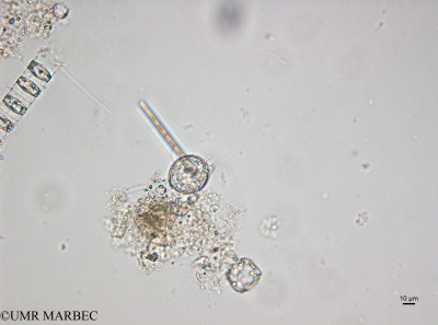 phyto/Brazilian_Amazon_coast/Amazomix_station_22/AMAZOMIX September 2021/Protoperidinium ovum (St22_DCM_proto2220913_001_ovl-1).tif(copy)_thumb.jpg